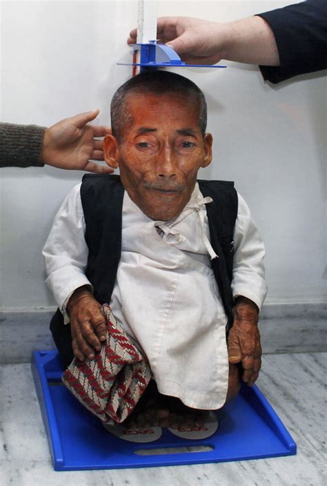 who is the smallest person in the world|Chandra Confirmed As World's Shortest Man .